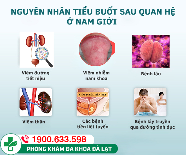 Hình ảnh minh họa